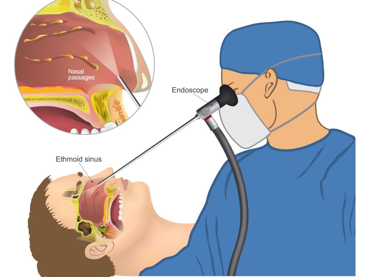 How to Find Right Sinus&nbsp;Specialist?